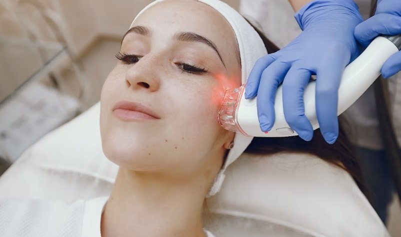 Pico Glow Laser: Unleashing the Power of Advanced Skin Rejuvenation